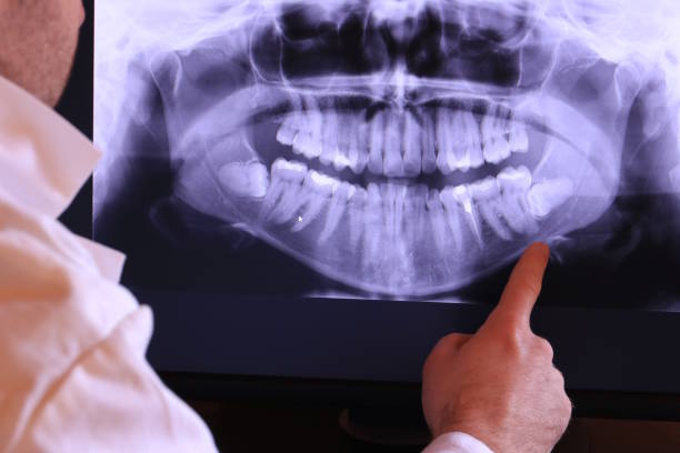Best Emergency Care for Gum Disease in Tillson, NY