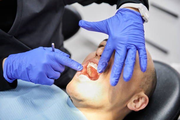 Best Emergency Treatment for Oral Infections in Tillson, NY
